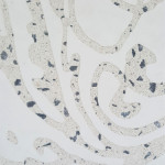 Finition décogravée